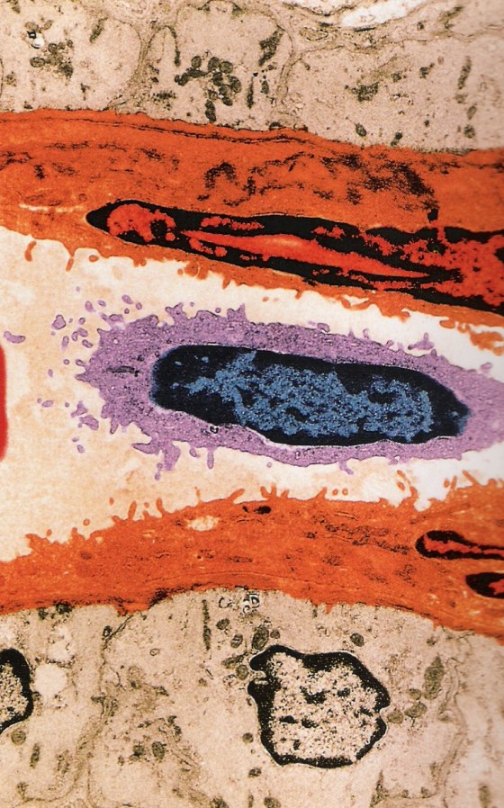 red-cell-in-a-vein