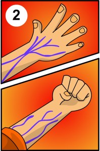 finding the good veins for self-infusion